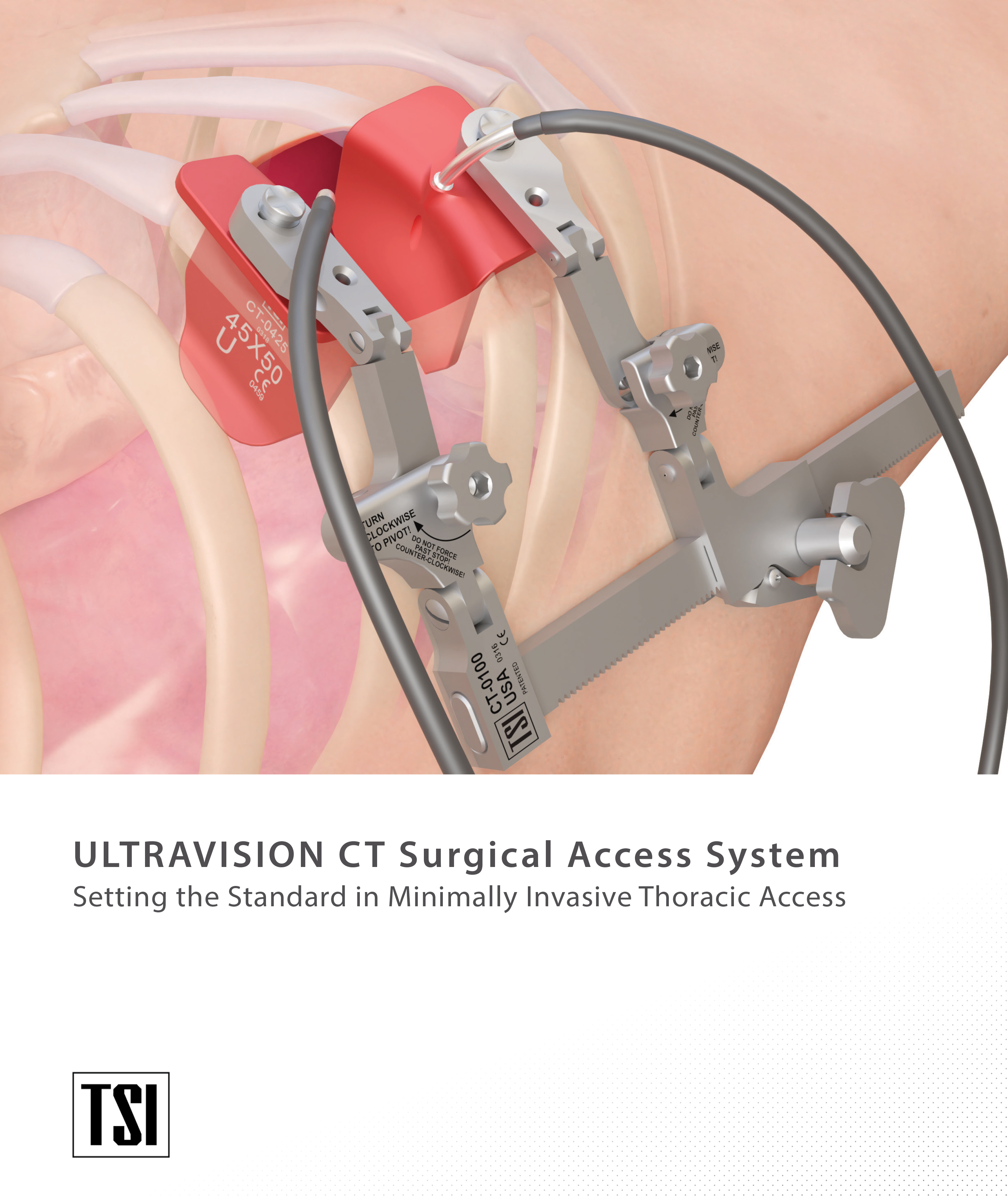 Ultravision CT Surgical Access System